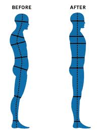 Structural Integration Before and After